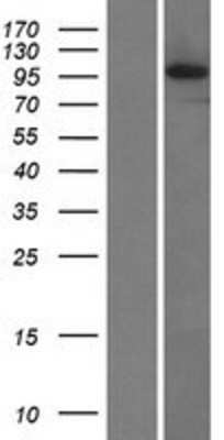 Western Blot: LRDD Overexpression Lysate (Adult Normal) [NBL1-12662] Left-Empty vector transfected control cell lysate (HEK293 cell lysate); Right -Over-expression Lysate for LRDD.