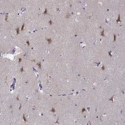 Immunohistochemistry-Paraffin: LRFN2 Antibody [NBP2-57321] - Staining of human cerebral cortex shows high expression.