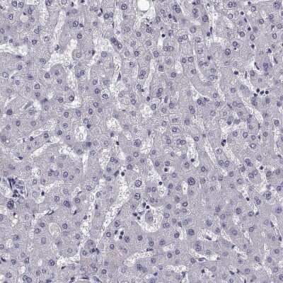 Immunohistochemistry-Paraffin: LRFN2 Antibody [NBP2-57321] - Staining of human liver shows low expression as expected.