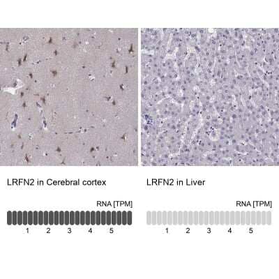 <b>Orthogonal Strategies Validation. </b>Immunohistochemistry-Paraffin: LRFN2 Antibody [NBP2-57321] - Staining in human cerebral cortex and liver tissues using anti-LRFN2 antibody. Corresponding LRFN2 RNA-seq data are presented for the same tissues.