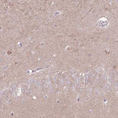 Immunohistochemistry-Paraffin: LRFN3 Antibody [NBP2-14199] Staining of human hippocampus shows moderate cytoplasmic positivity in fraction of neuronal cells.