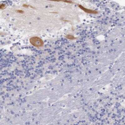 Immunohistochemistry-Paraffin: LRFN5 Antibody [NBP1-88412] - Staining of human cerebellum shows moderate cytoplasmic positivity in Purkinje cells.
