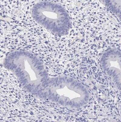 Immunohistochemistry-Paraffin: LRFN5 Antibody [NBP1-88412] - Staining of human endometrium shows no positivity in glandular cells.