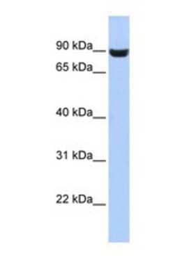 Western Blot: LRFN5 Antibody [NBP1-69704] - This Anti-LRFN5 antibody was used in Western Blot of HepG2     tissue lysate at a concentration of 1ug/ml.