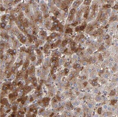 Immunohistochemistry-Paraffin: LRG1 Antibody [NBP1-82823] -  Staining of human liver shows weak to moderate cytoplasmic positivity in hepatocytes.