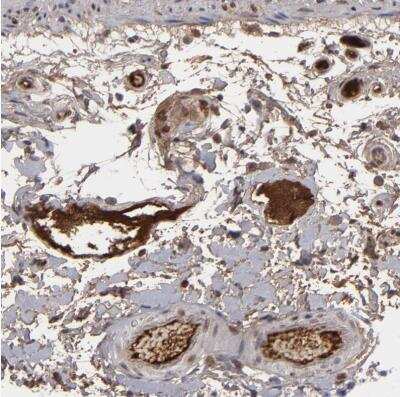 Immunohistochemistry-Paraffin: LRG1 Antibody [NBP1-82823] - Staining of human colon shows weak to moderate positivity in plasma.