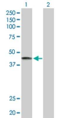 Western Blot: LRG1 Antibody [H00116844-D01P] - Analysis of LRG1 expression in transfected 293T cell line by LRG1 polyclonal antibody.Lane 1: LRG1 transfected lysate(38.20 KDa).Lane 2: Non-transfected lysate.