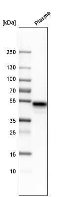 <b>Orthogonal Strategies Validation. </b>Western Blot: LRG1 Antibody [NBP1-82823] - Analysis in human plasma.