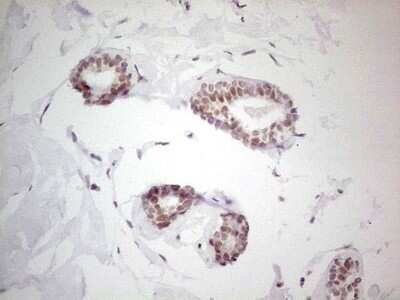 Immunohistochemistry: LRH-1/NR5A2 Antibody (3H8) [NBP2-46248] - Analysis of Human breast tissue. (Heat-induced epitope retrieval by 1 mM EDTA in 10mM Tris, pH8.5, 120C for 3min)