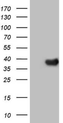 Western Blot: LRH-1/NR5A2 Antibody (3H8) [NBP2-46248] - Human recombinant protein fragment corresponding to amino acids 1-303 of human NR5A2(NP_995582) produced in E.coli.