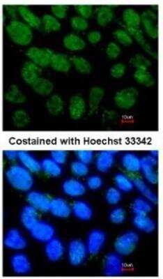 Immunocytochemistry/Immunofluorescence: LRH-1/NR5A2 Antibody [NBP1-32489] - Paraformaldehyde-fixed Human ESC, using NR5A2 antibody at 1:400 dilution.