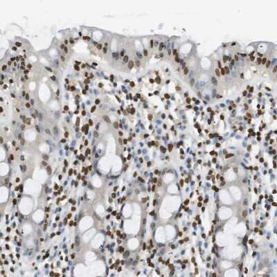 Immunohistochemistry-Paraffin: LRH-1/NR5A2 Antibody [NBP1-90048] - Staining of human rectum shows nuclear positivity in glandular cells.