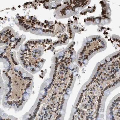 Immunohistochemistry-Paraffin: LRH-1/NR5A2 Antibody [NBP1-90048] - Staining of human Duodenum shows strong nuclear positivity in glandular cells.