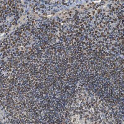 Immunohistochemistry-Paraffin: LRH-1/NR5A2 Antibody [NBP1-90048] - Staining of human Lymph node shows strong nuclear positivity in germinal and non-germinal center cells.