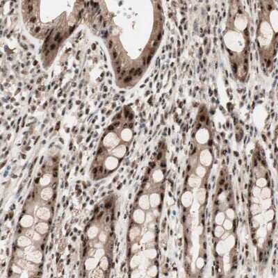 Immunohistochemistry-Paraffin: LRH-1/NR5A2 Antibody [NBP1-90049] - Staining of human rectum shows nuclear positivity in glandular cells.
