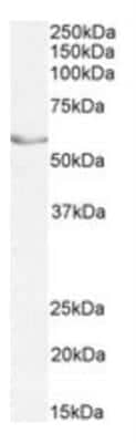 Western Blot: LRH-1/NR5A2 Antibody [NBP2-42513] - Staining of Pig Ovary lysate (35ug protein in RIPA buffer). Primary incubation was 1 hour. Detected by chemiluminescence.