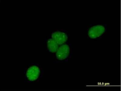 Immunocytochemistry/ Immunofluorescence LRIF1 Antibody