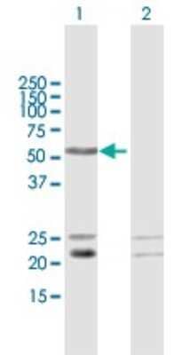 Western Blot LRIF1 Antibody