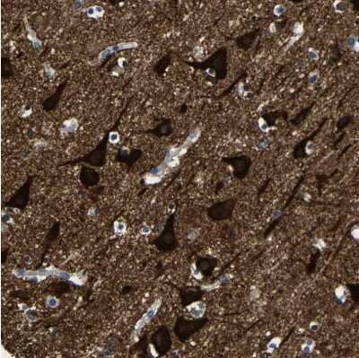 Immunohistochemistry-Paraffin: LRIG1 Antibody [NBP2-30926] - LIG1 Antibody [NBP2-30926] -  positivity in neurons.