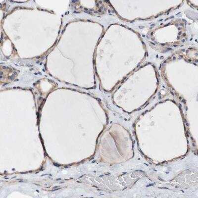 Immunohistochemistry-Paraffin: LRIG3 Antibody [NBP1-81877] - Staining of human thyroid gland shows moderate cytoplasmic positivity in glandular cells.