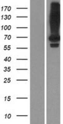 Western Blot: LRIT2 Overexpression Lysate (Adult Normal) [NBP2-08679] Left-Empty vector transfected control cell lysate (HEK293 cell lysate); Right -Over-expression Lysate for LRIT2.