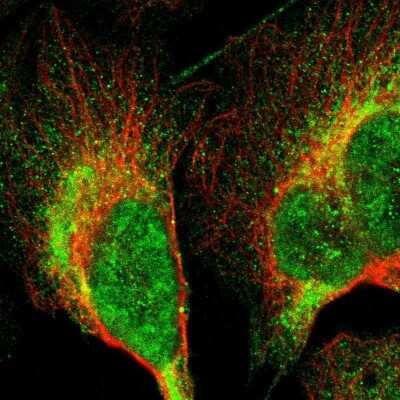 Immunocytochemistry/Immunofluorescence: LRIT3 Antibody [NBP1-83895] - Immunofluorescent staining of human cell line U-2 OS shows localization to nucleoplasm, cytosol & mitochondria.