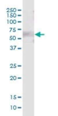 Western Blot: LRIT3 Antibody [H00345193-B01P] - Analysis of LRIT3 expression in human colon.