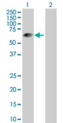 Western Blot: LRIT3 Antibody [H00345193-D01P] - Analysis of LRIT3 expression in transfected 293T cell line by LRIT3 polyclonal antibody.Lane 1: LRIT3 transfected lysate(60.50 KDa).Lane 2: Non-transfected lysate.