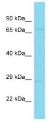 Western Blot: LRIT3 Antibody [NBP3-09749] - Western blot analysis of LRIT3 in Human MCF7 Whole Cell. Antibody dilution at 1ug/ml