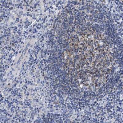 Immunohistochemistry-Paraffin: LRMP/Jaw1 Antibody [NBP1-87723] - Staining of human lymph node shows high expression.