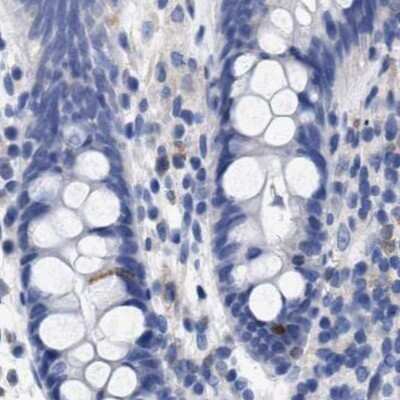 Immunohistochemistry-Paraffin: LRMP/Jaw1 Antibody [NBP1-87723] - Staining of human colon.