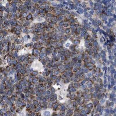 Immunohistochemistry-Paraffin: LRMP/Jaw1 Antibody [NBP1-87723] - Staining of human tonsil.