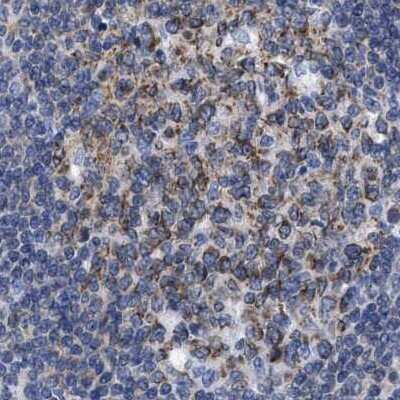 Immunohistochemistry-Paraffin: LRMP/Jaw1 Antibody [NBP1-87723] - Staining of human lymph node using Anti-LRMP antibody NBP1-87723.