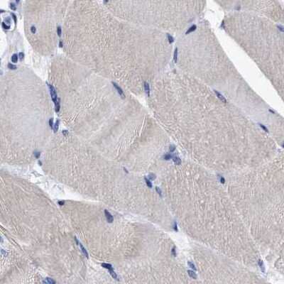 Immunohistochemistry-Paraffin: LRMP/Jaw1 Antibody [NBP1-87723] - Staining of human skeletal muscle using Anti-LRMP antibody NBP1-87723.