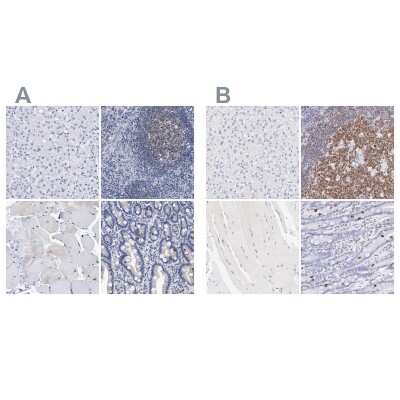 <b>Independent Antibodies Validation and Orthogonal Strategies Validation.</b>Immunohistochemistry-Paraffin: LRMP/Jaw1 Antibody [NBP1-87723] - Staining of human liver, lymphoid tissues, skeletal muscle and upper gastrointestinal using Anti-LRMP/Jaw1 antibody NBP1-87723 (A) shows similar protein distribution across tissues to independent antibody NBP1-87724 (B).