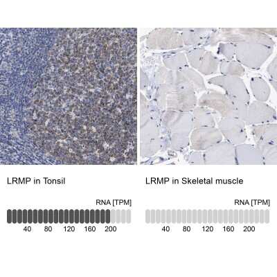 Immunohistochemistry-Paraffin: LRMP/Jaw1 Antibody [NBP1-87723] - Analysis in human tonsil and skeletal muscle tissues using NBP1-87723 antibody. Corresponding LRMP/Jaw1 RNA-seq data are presented for the same tissues.