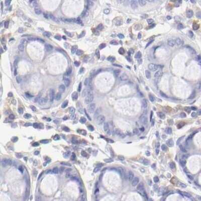 Immunohistochemistry-Paraffin: LRMP/Jaw1 Antibody [NBP1-87724] - Staining of human colon.