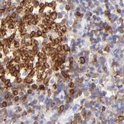 Immunohistochemistry-Paraffin: LRMP/Jaw1 Antibody [NBP1-87724] - Staining of human tonsil.