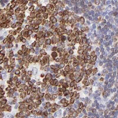 Immunohistochemistry-Paraffin: LRMP/Jaw1 Antibody [NBP1-87724] - Staining of human lymph node using Anti-LRMP antibody NBP1-87724.