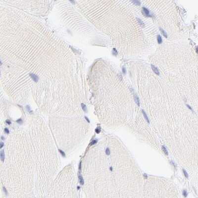 Immunohistochemistry-Paraffin: LRMP/Jaw1 Antibody [NBP1-87724] - Staining of human skeletal muscle using Anti-LRMP antibody NBP1-87724.