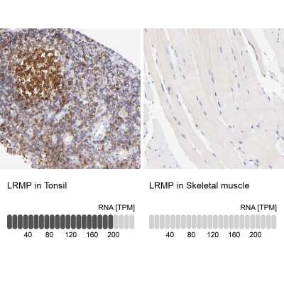 Immunohistochemistry-Paraffin: LRMP/Jaw1 Antibody [NBP1-87724] - Analysis in human tonsil and skeletal muscle tissues using NBP1-87724 antibody. Corresponding LRMP/Jaw1 RNA-seq data are presented for the same tissues.