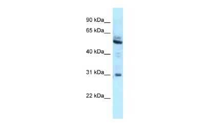 Western Blot: LRMP/Jaw1 Antibody [NBP2-87738] - WB Suggested Anti-LRMP Antibody. Titration: 1.0 ug/ml. Positive Control: A549 Whole Cell