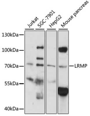 Western Blot: LRMP/Jaw1 Antibody [NBP3-03425] - Analysis of extracts of various cell lines, using LRMP/Jaw1 antibody at 1:1000 dilution. Secondary antibody: HRP Goat Anti-Rabbit IgG (H+L) at 1:10000 dilution. Lysates/proteins: 25ug per lane. Blocking buffer: 3% nonfat dry milk in TBST. Detection: ECL Basic Kit.