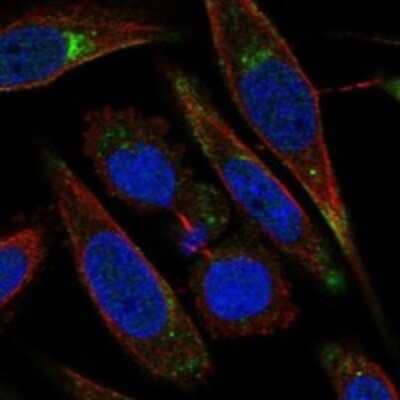 Immunocytochemistry/Immunofluorescence: LRP-11 Antibody [NBP3-17732] - Staining of human cell line SiHa shows localization to plasma membrane & vesicles.