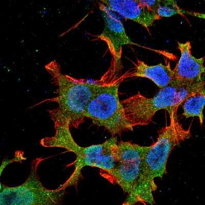 Immunocytochemistry/Immunofluorescence: LRP-4 Antibody (S164-6) [NBP2-22417] - Tissue: Neuroblastoma cell line SK-N-BE. Species: Human. Fixation: 4% Formaldehyde for 15 min at RT. Primary Antibody: Mouse Anti-LRP4 (Cytoplasmic) Monoclonal Antibody at 1:100 for 60 min at RT. Secondary Antibody: Goat Anti-Mouse ATTO 488 at 1:100 for 60 min at RT. Counterstain: Phalloidin Texas Red F-Actin stain; DAPI (blue) nuclear stain at 1:1000, 1:5000 for 60min RT, 5min RT. Localization: Membrane. Magnification: 60X.