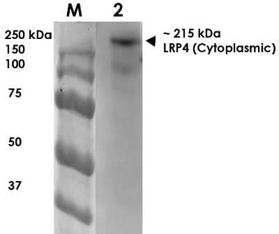 Western Blot: LRP-4 Antibody (S164-6) [NBP2-22417] - analysis of Rat Brain Membrane showing detection of 215 kDa LRP4 protein using Mouse Anti-LRP4 Monoclonal Antibody, Clone S164-6 . Lane 1: MW Ladder. Lane 2: Rat Brain Membrane (10 ug). . Load: 10 ug. Block: 5% milk. Primary Antibody: Mouse Anti-LRP4 Monoclonal Antibody at 1:1000 for 1 hour at RT. Secondary Antibody: Goat Anti-Mouse IgG: HRP at 1:200 for 1 hour at RT. Color Development: TMB solution for 10 min at RT. Predicted/Observed Size: 215 kDa.