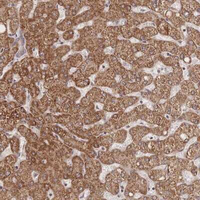 Immunohistochemistry-Paraffin: LRP-5 Antibody [NBP2-37868] - Staining of human liver shows strong cytoplasmic positivity in hepatocytes.