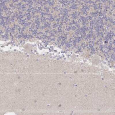 Immunohistochemistry-Paraffin: LRP-5 Antibody [NBP2-37868] - Staining of human cerebellum shows no positivity in neurons as expected.