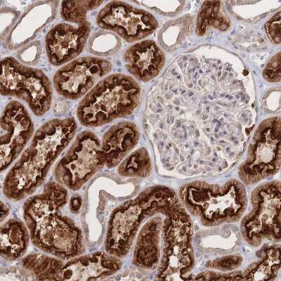 Immunohistochemistry-Paraffin: LRP-5 Antibody [NBP2-37868] - Staining of human kidney shows strong cytoplasmic positivity in cells in tubules.