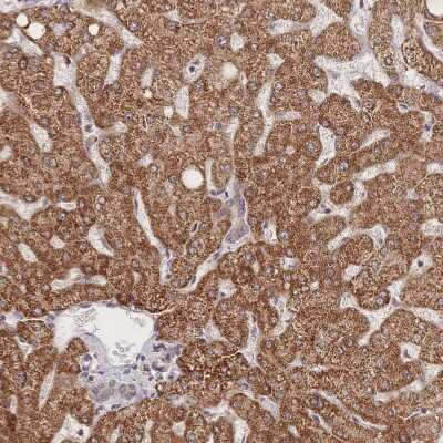 Immunohistochemistry-Paraffin: LRP-5 Antibody [NBP2-37868] - Staining of human liver shows strong cytoplasmic positivity in hepatocytes.